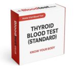 Thyroid Blood Test Guide for Residents of Newport